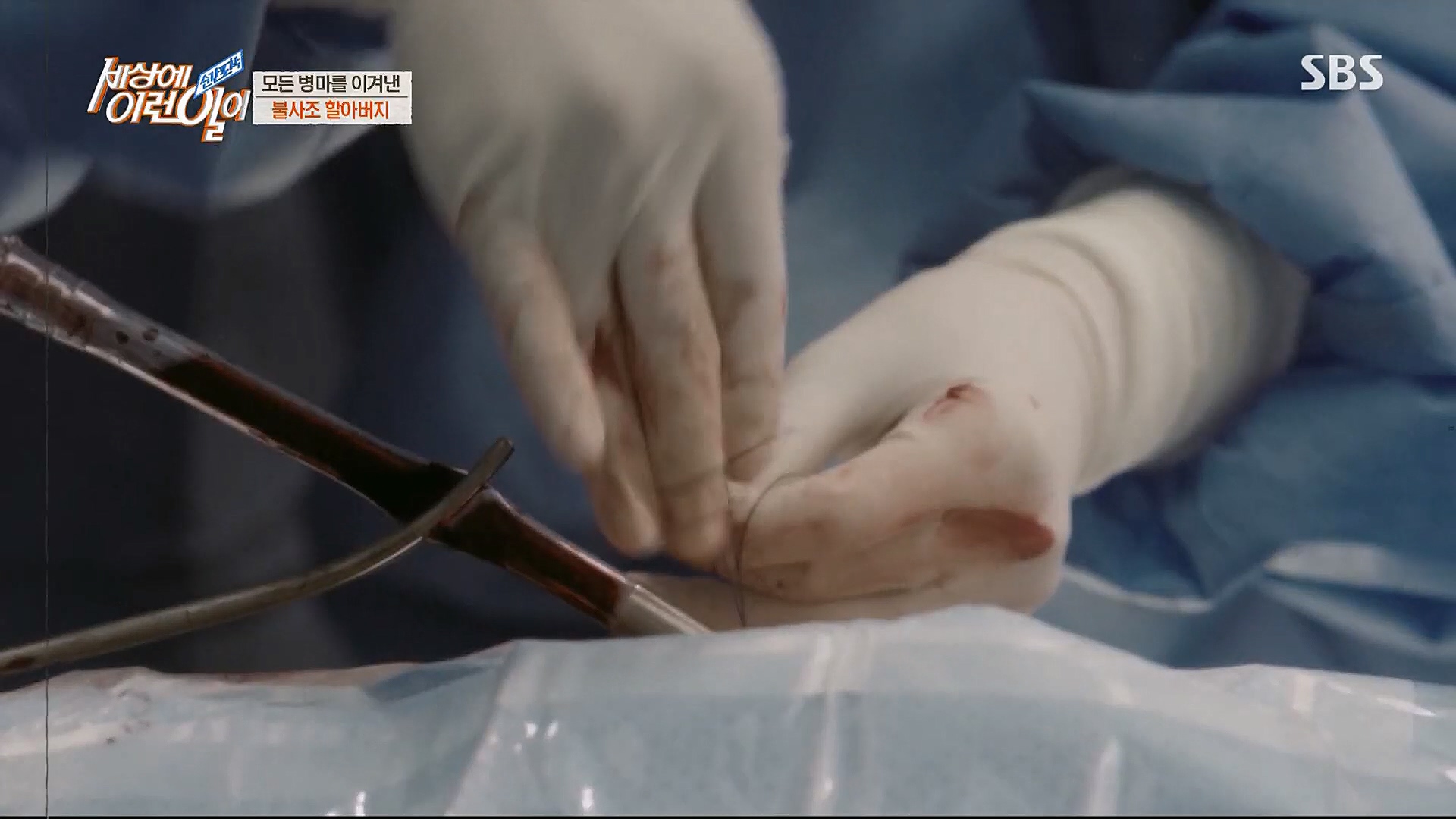 순간포착 세상에 이런일이.E1213.230110p.H264-F1RST.mp4_20230111_194916.821.jpg