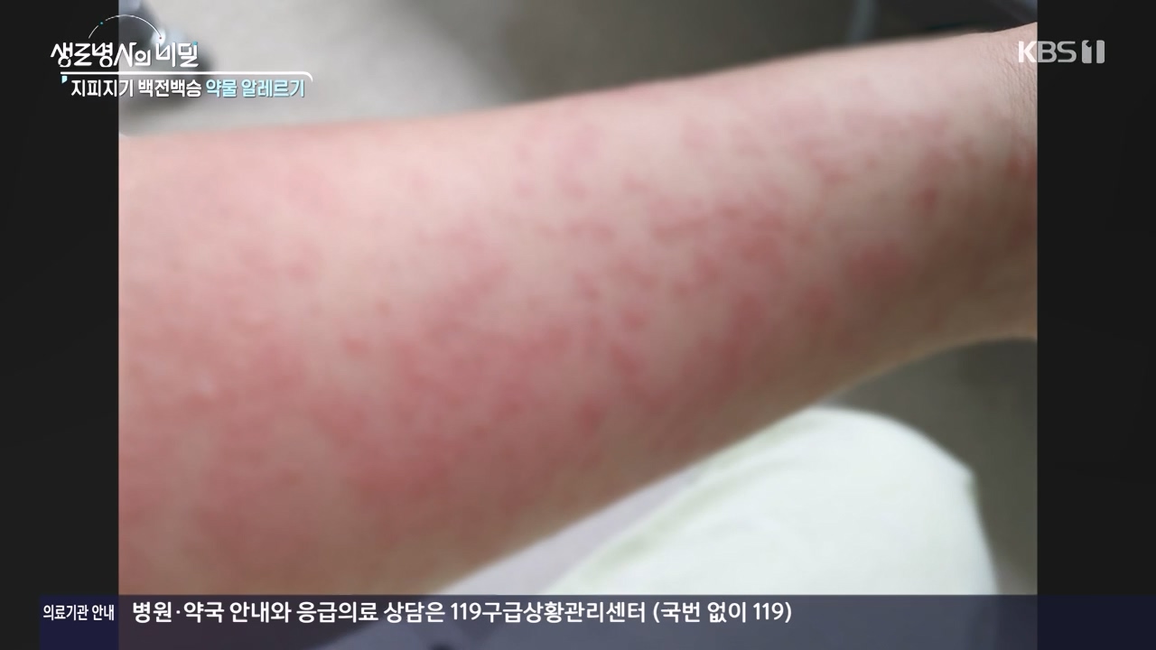 생로병사의 비밀.E910.240509p-NEXT.mp4_20240509_202515.035.jpg