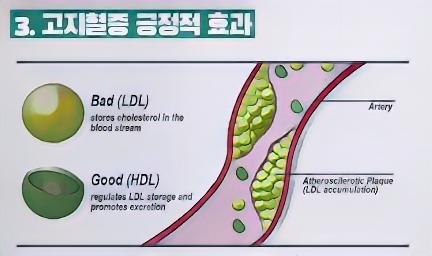 비타민 D 고지혈증 조절 효과