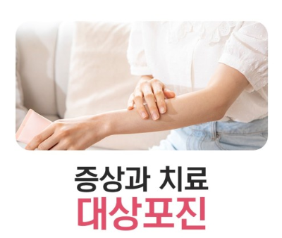 대상포진증상