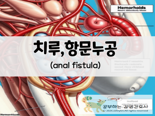 성인 간호_치루(anal fistula)원인, 증상, 수술, 회복 기간, 간호 진단