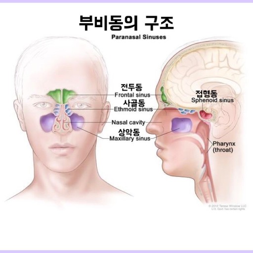 부비동염