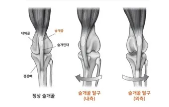 강아지 슬개골 탈구 수술 후유증_32