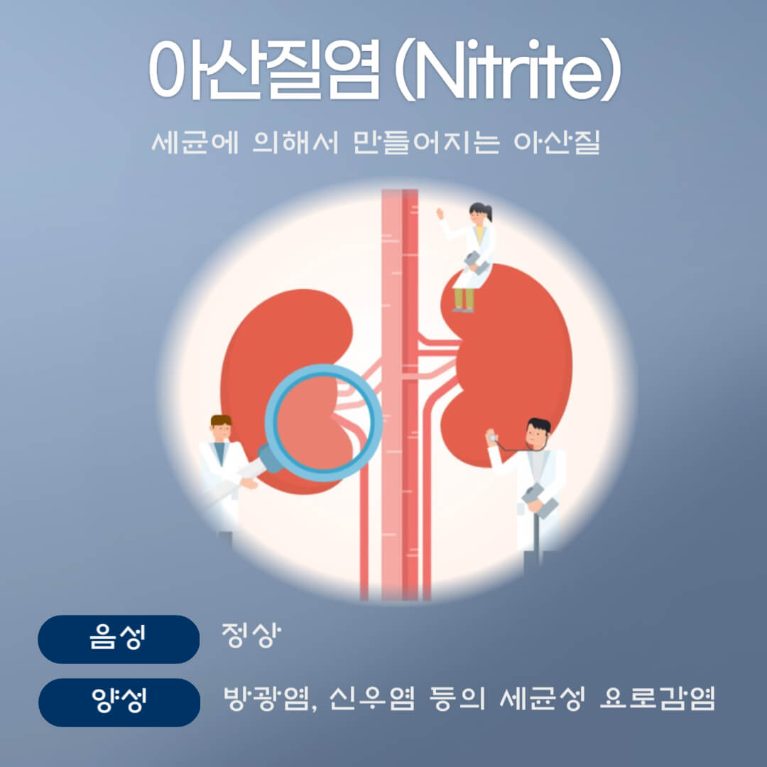 아산질염