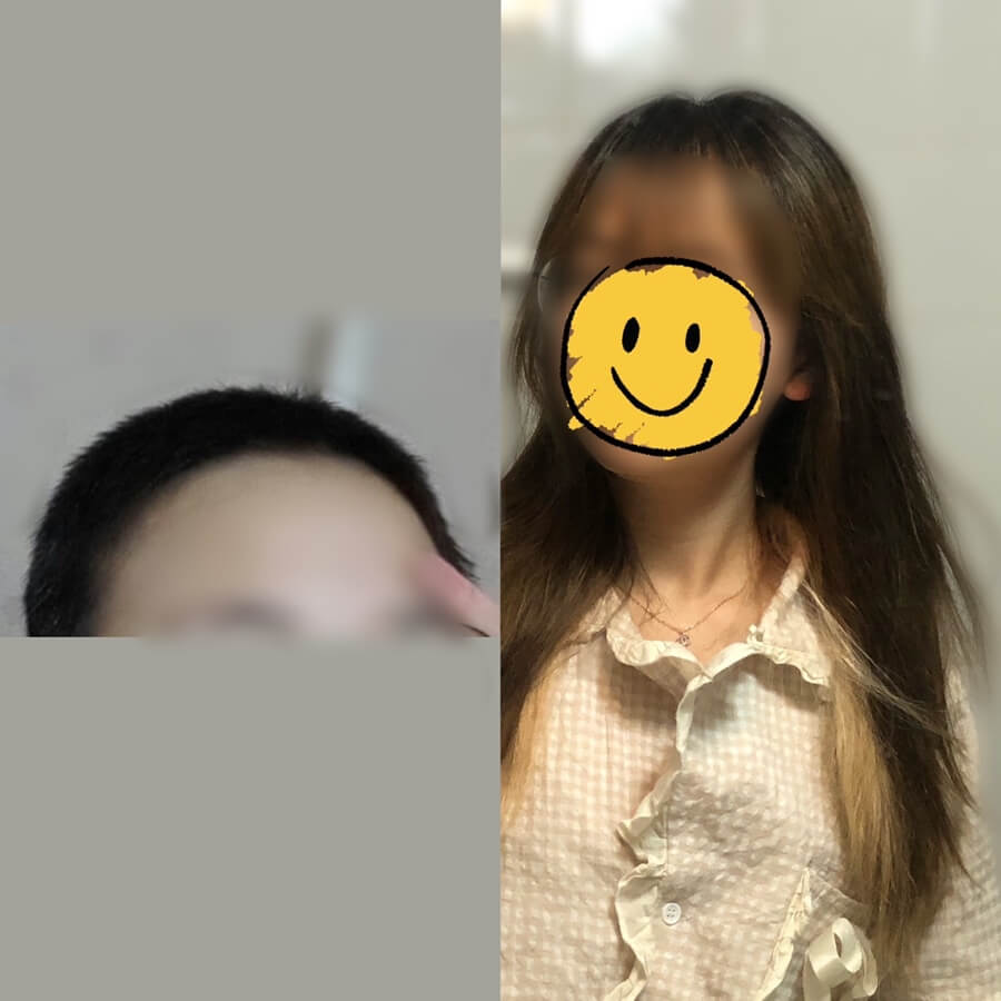  여자 반삭 후 장발까지, 2년 동안 기르는 과정