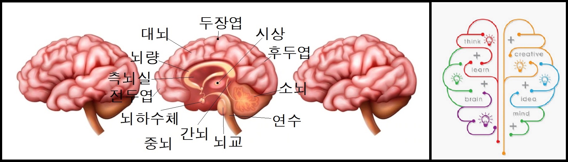  뇌종양. 뇌종양 증상. 구토.