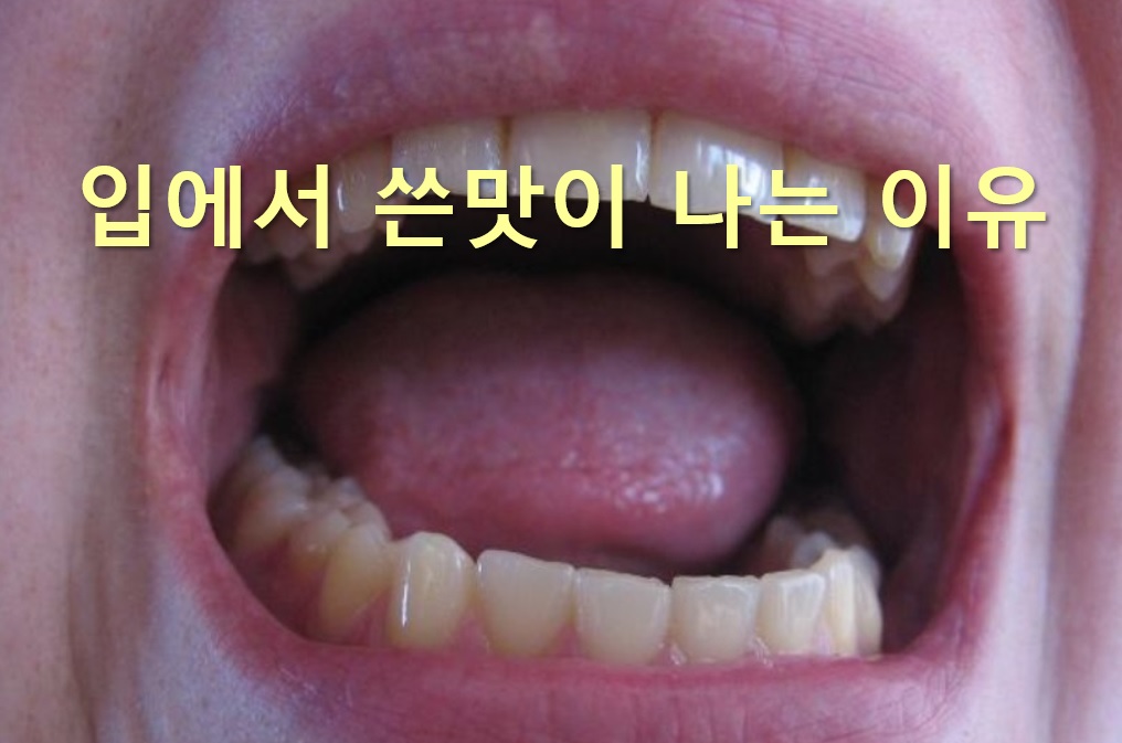  입에서 쓴맛이 나는 이유와 입에서 단내가 나는 이유