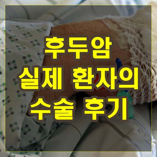 후두암 실제 환자의 수술 후기