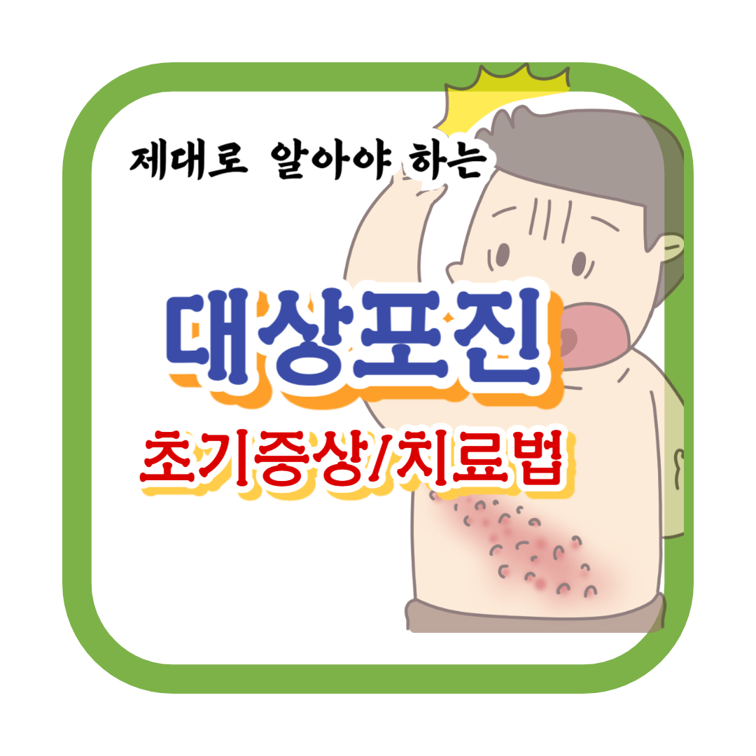 대상포진-초기증상-치료방법-전염