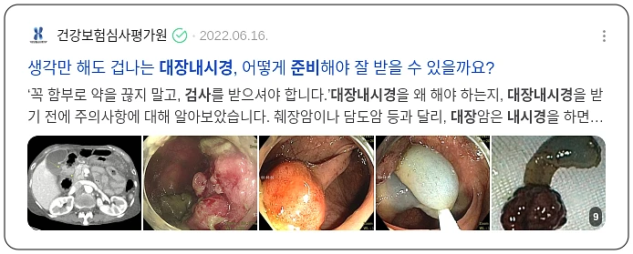 대장내시경 검사 준비_2_subsection