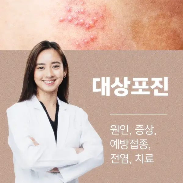 대상포진 원인&amp;#44; 증상&amp;#44; 예방접종&amp;#44; 전염&amp;#44; 치료
