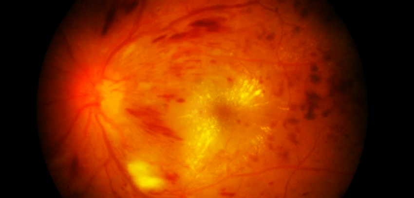 article thumbnail image