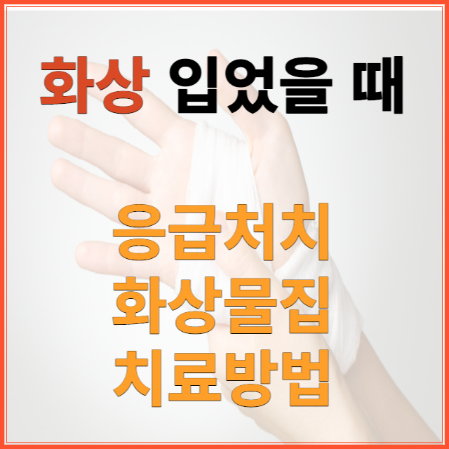 화상 응급처치