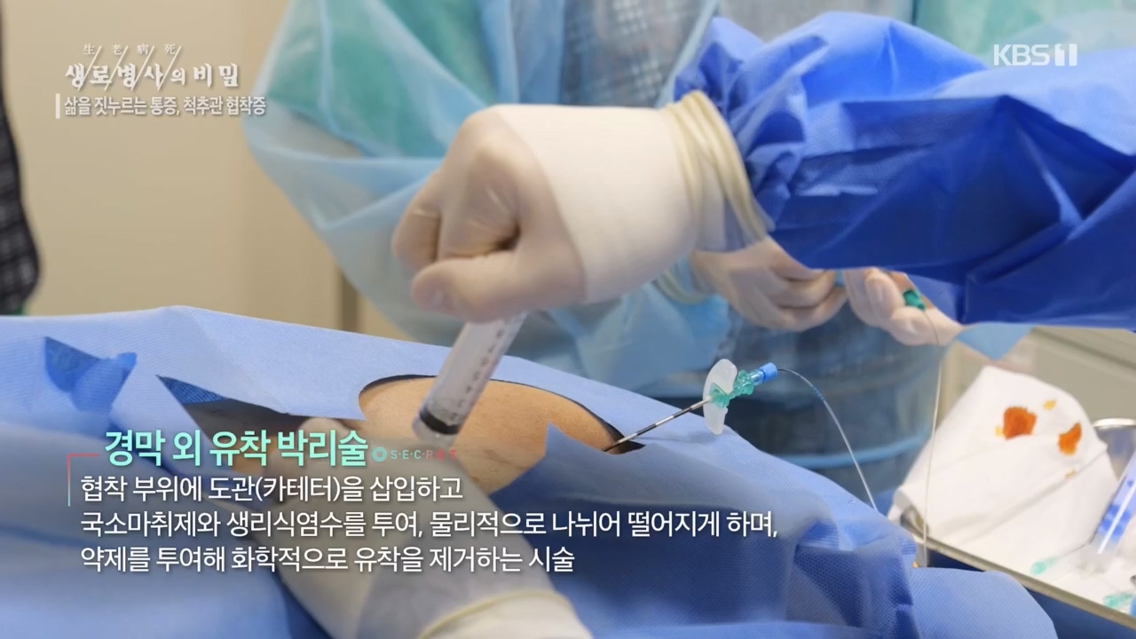 생로병사의 비밀.E866.230427p.H264-F1RST.mp4_20230427_202705.565.jpg