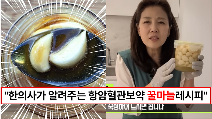 “마늘이 혈관보약, 항암효과를 냅니다” 한의사가 추천하는 온가족 건강을 책임지는 꿀마늘 만드는 방법