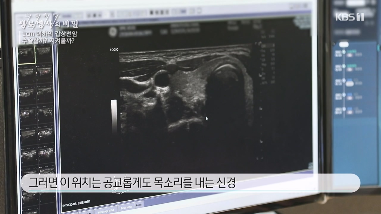 생로병사의 비밀.E894.231228p-NEXT.mp4_20231228_195505.441.jpg