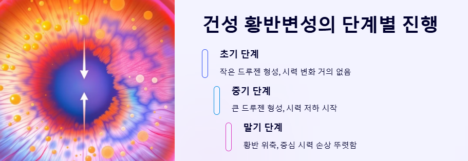 황반변성 증상 자가진단 원인 치료법 좋은음식 예방법