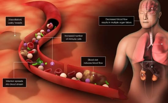 면역 체계의 모든 것 Immune System