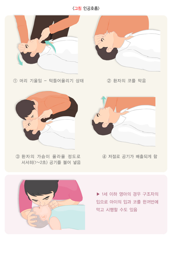인공 호흡 방법