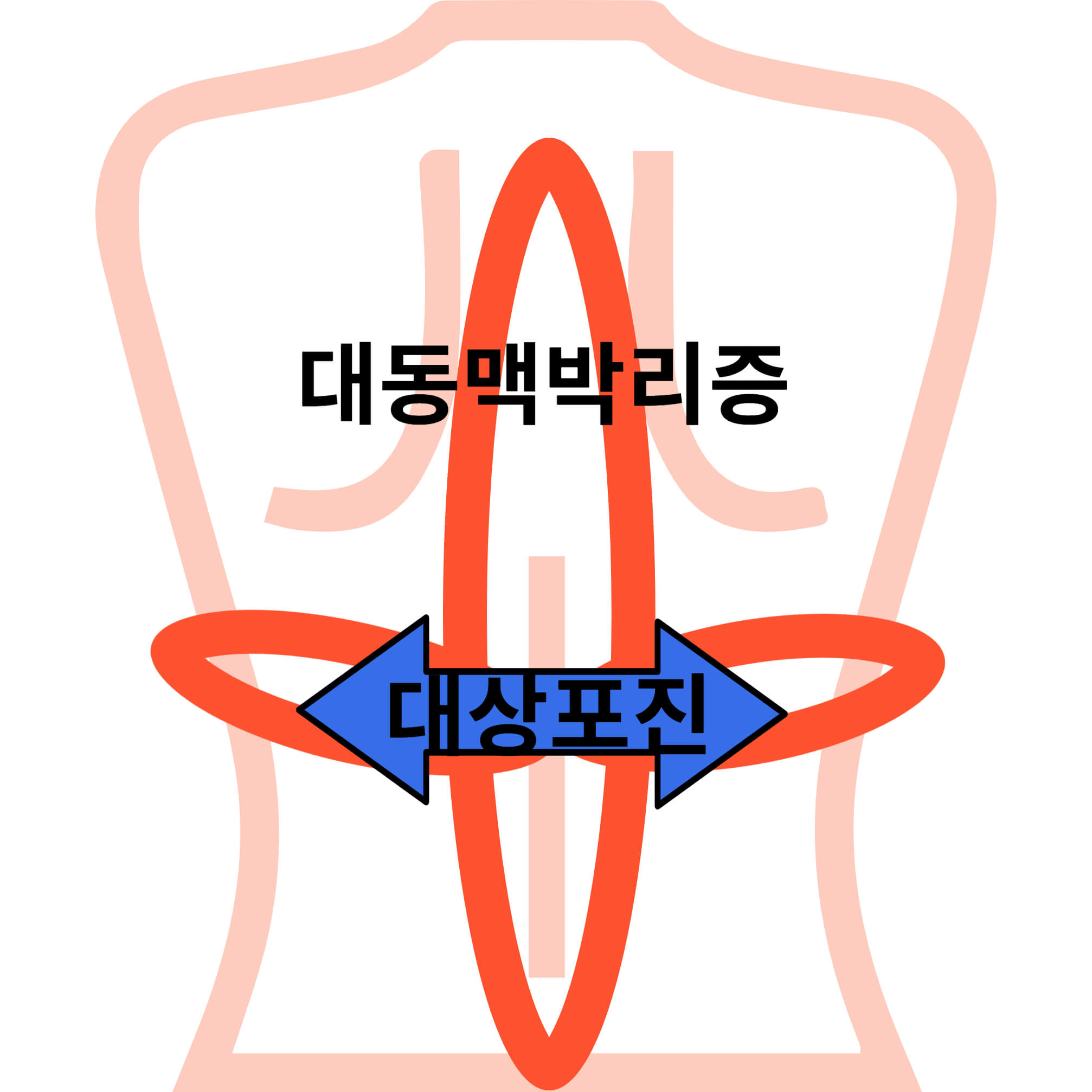 등통증 위치별 의심 질병