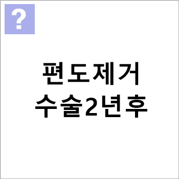 편도제거수술2년후