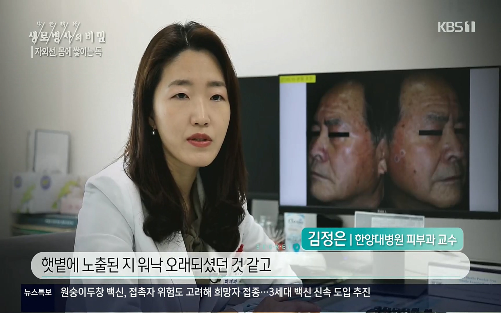 생로병사의 비밀.E824.220629p.H264-F1RST.mp4_20220630_203808.511.jpg