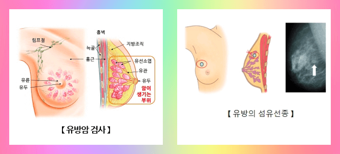 유방암 검사