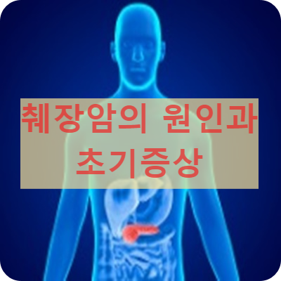 췌장암 초기 증상과 원인 알아보기 1