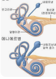 어지러움증의 원인