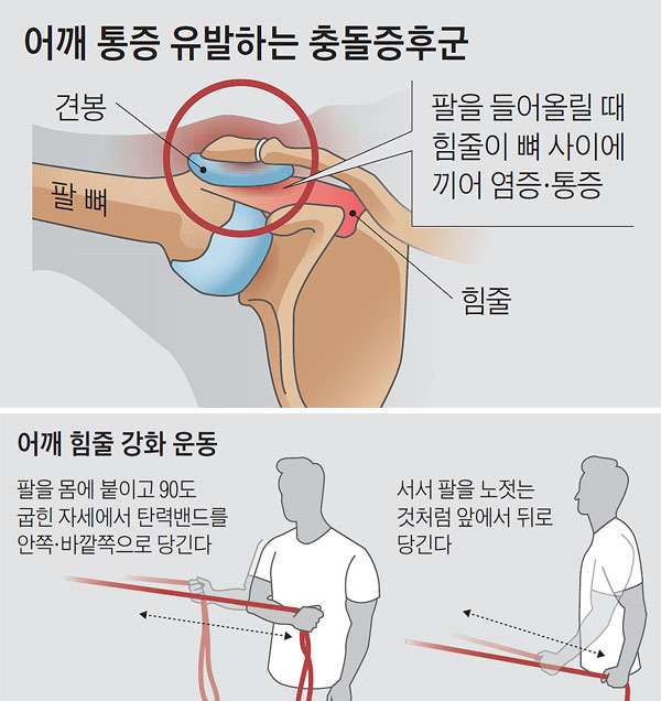  어깨통증 원인 4가지 총정리