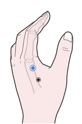 검지 손가락 통증