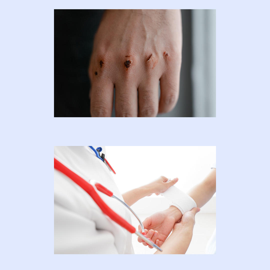 상처 관련 사진