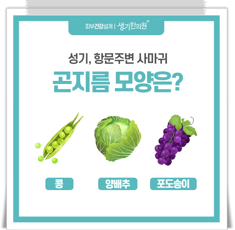 항문곤지름 13