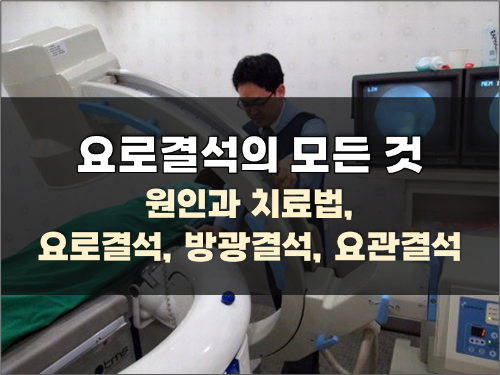  요로결석의 종류, 원인과 치료법 (요로결석, 방광결석, 요관결석)