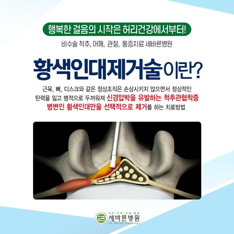  척추관협착증 증상, 원인 그리고 치료방법 궁금