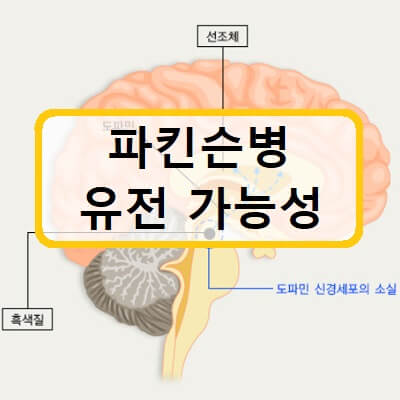 파킨슨병-유전-가능성-썸네일