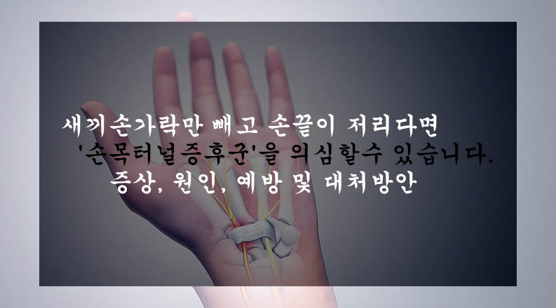  새끼손가락만 빼고 손끝이 저리다면 '손목터널증후군'을 의심할수 있습니다: 증상, 원인, 예방 및 대처방안