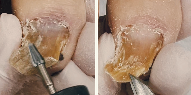 노인성-조갑구만증-관리-전-2개-모음집-사진