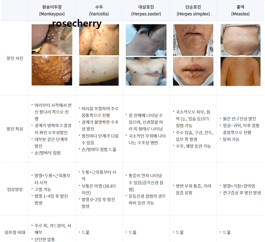 원숭이두창과-다른-피부질환의-발진-양상-및-특징-차이점