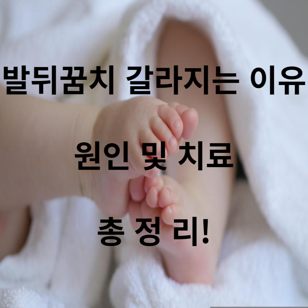 발뒤꿈치 갈라지는 이유 원인 치료 총정리