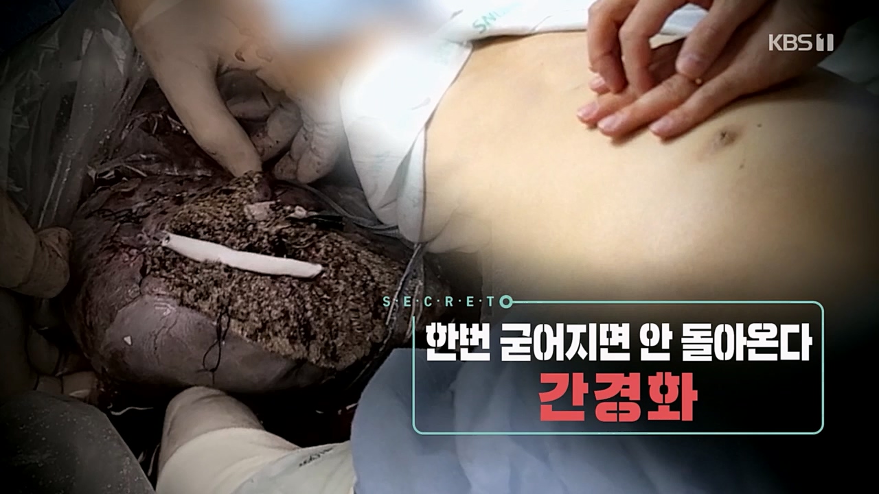 생로병사의 비밀.E863.230406p.H264-F1RST.mp4_20230406_202713.575.jpg