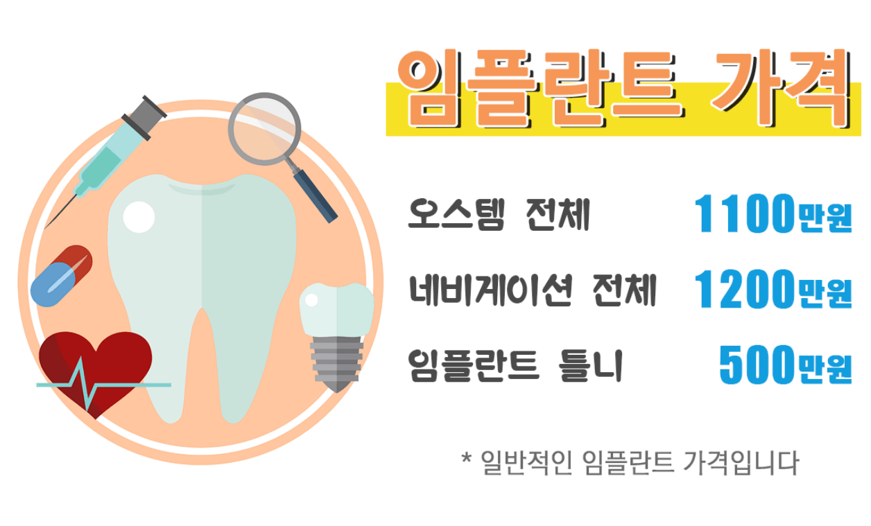 임플란트 가격 비용 비교하기