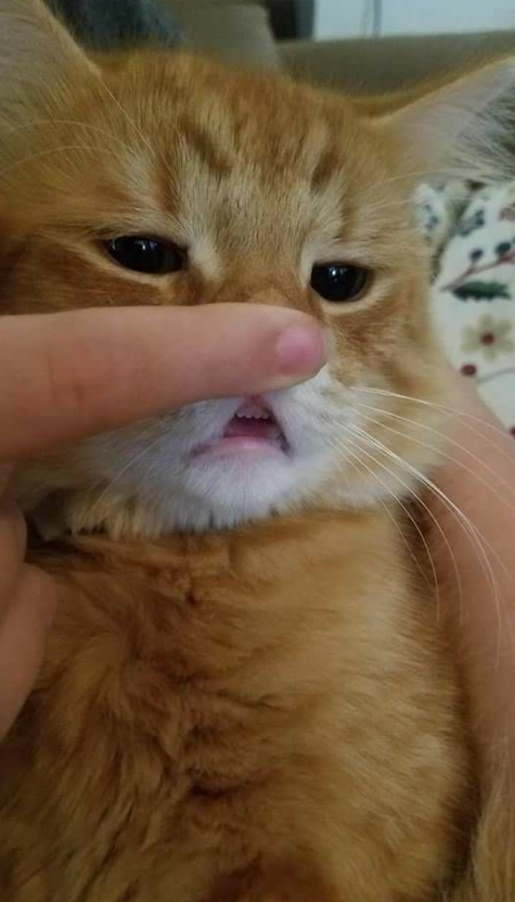  아가 고영희 앞니