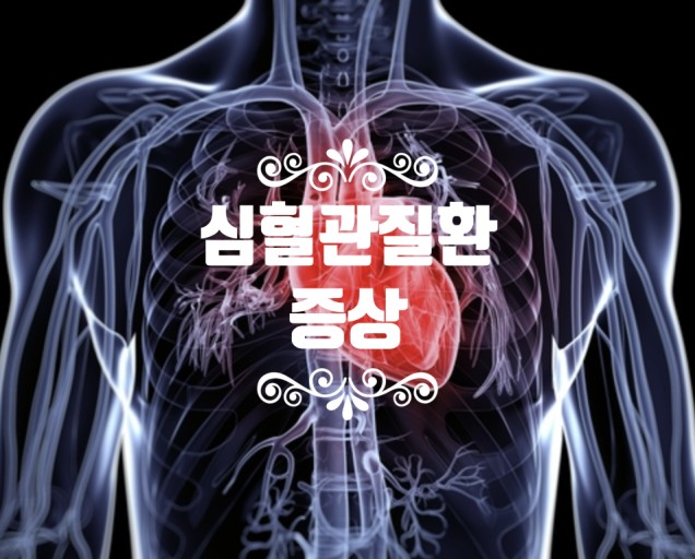  심혈관 질환이란? 심장질환의 모든것!!