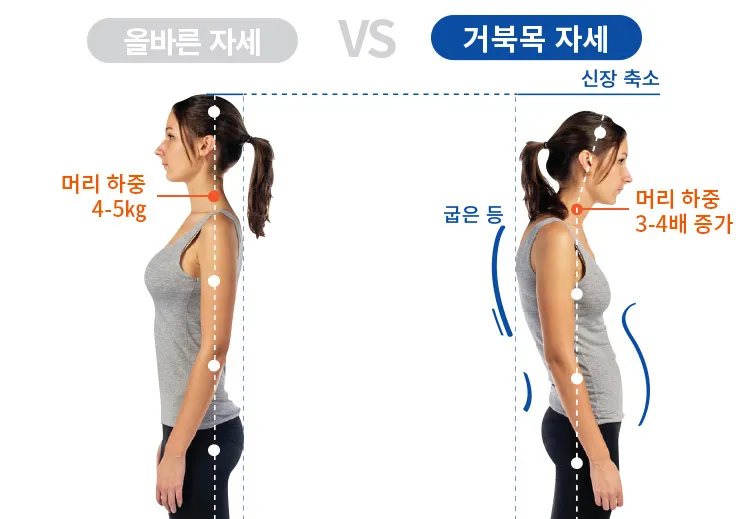 거북목 증상 치료법 스트레칭_5