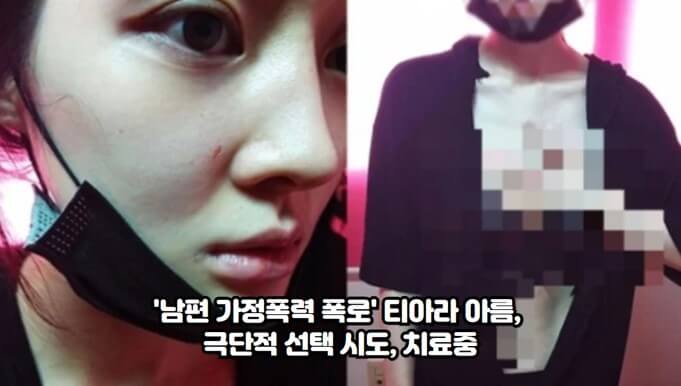 티아라 출신 가수 이아름이 남편의 가정폭력과 아동학대를 폭로하고 극단적 선택을 시도한 사실이 전해졌다.
이아름은 남편과의 갈등을 고백하며 이혼 소송을 진행 중이었고&#44; 남편이 아들들을 학대했다는 주장을 내놨다.
이아름은 폭행당한 상처 가득한 얼굴과 신체 사진을 공개하며 경찰에 신고하고 피해를 호소했다.
이아름은 티아라 출신으로 데뷔하고 솔로 가수로 활동한 후 다양한 프로젝트에 참여했다.