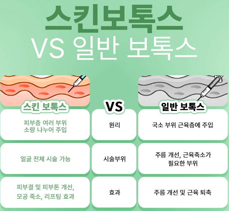 스킨보톡스와 일반보톡스의 차이점 사진