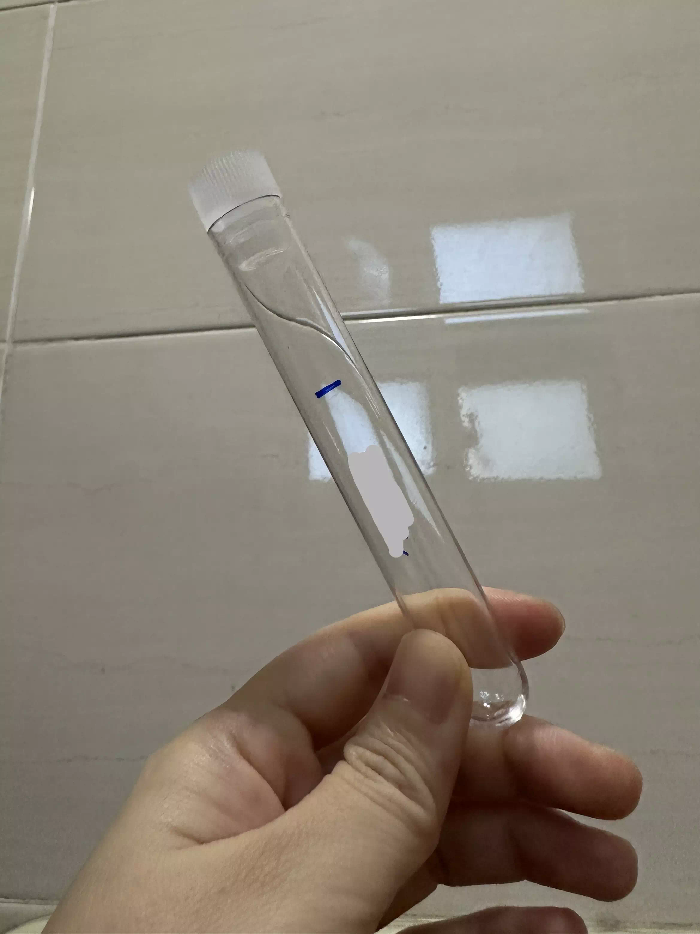 막달검사-소변검사