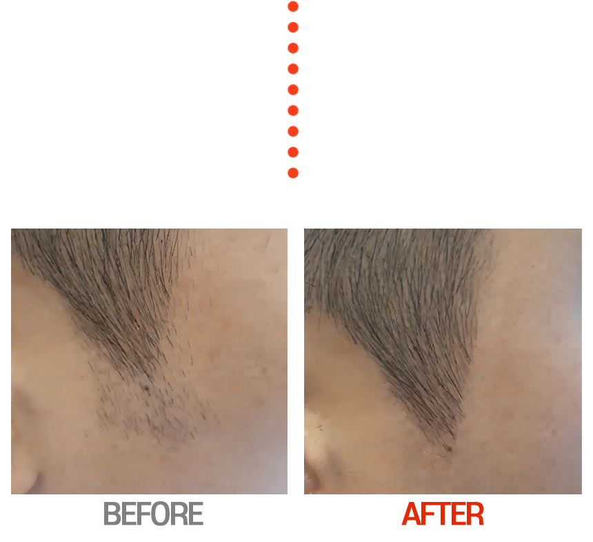 Before and After