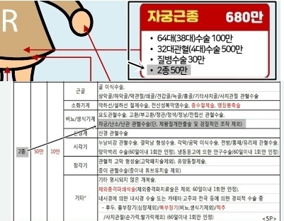 난소낭종 자궁근종 동시에 수술시 질병수술비 종수술비 보상방법